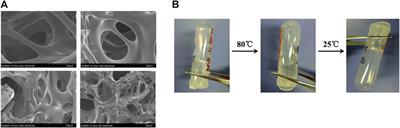 AM1241-Loaded Poly(ethylene glycol)–Dithiothreitol Hydrogel Repairs Cranial Bone Defects by Promoting Vascular Endothelial Growth Factor and COL-1 Expression